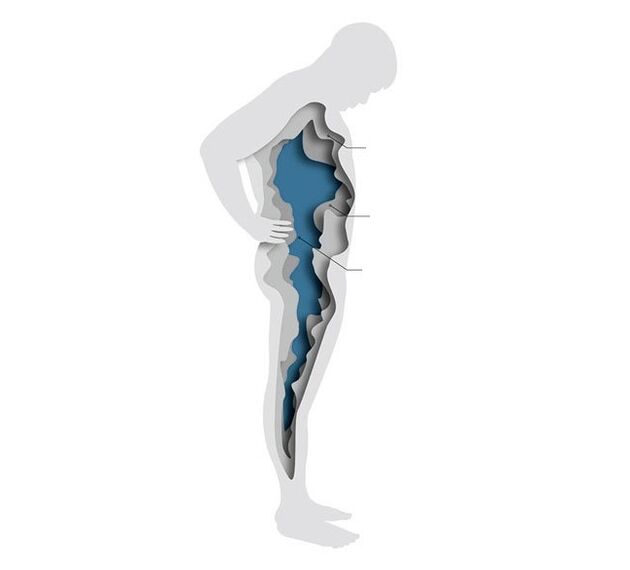 Hormones and excess weight